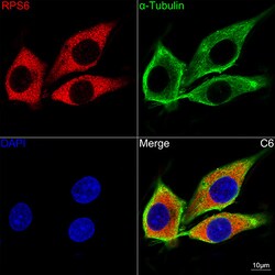 Invitrogen S6 Recombinant Rabbit Monoclonal Antibody (4C7P4) 100 &mu;L;