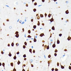 Invitrogen NeuN Recombinant Rabbit Monoclonal Antibody (2F9F0) 100 &mu;L;
