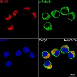 Invitrogen NSE Recombinant Rabbit Monoclonal Antibody (9B4Y4) 100 &mu;L;
