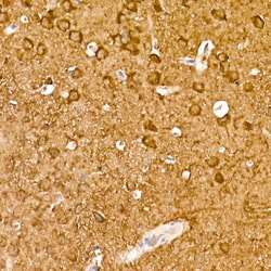 Invitrogen NSE Recombinant Rabbit Monoclonal Antibody (9B4Y4) 100 &mu;L;