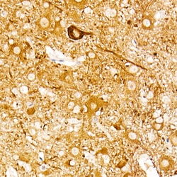 Invitrogen NSE Recombinant Rabbit Monoclonal Antibody (9B4Y4) 100 &mu;L;