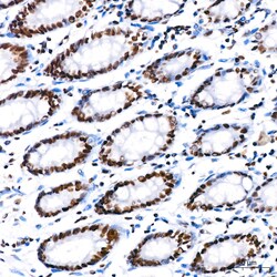 Invitrogen PARP1 Recombinant Rabbit Monoclonal Antibody (2G8N7) 100 &mu;L | Buy Online | Invitrogen&trade; | Fisher Scientific