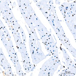 Invitrogen PARP1 Recombinant Rabbit Monoclonal Antibody (2G8N7) 100 &mu;L | Buy Online | Invitrogen&trade; | Fisher Scientific