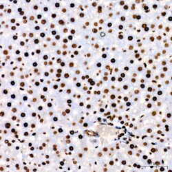 Invitrogen PARP1 Recombinant Rabbit Monoclonal Antibody (2G8N7) 100 &mu;L | Buy Online | Invitrogen&trade; | Fisher Scientific