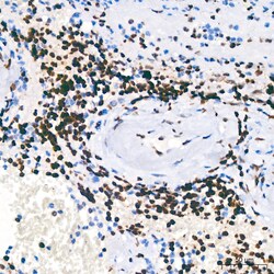 Invitrogen PARP1 Recombinant Rabbit Monoclonal Antibody (2G8N7) 100 &mu;L | Buy Online | Invitrogen&trade; | Fisher Scientific