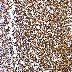 Invitrogen PARP1 Recombinant Rabbit Monoclonal Antibody (2G8N7) 100 &mu;L | Buy Online | Invitrogen&trade; | Fisher Scientific