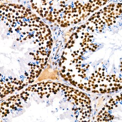 Invitrogen PARP1 Recombinant Rabbit Monoclonal Antibody (2G8N7) 100 &mu;L | Buy Online | Invitrogen&trade; | Fisher Scientific