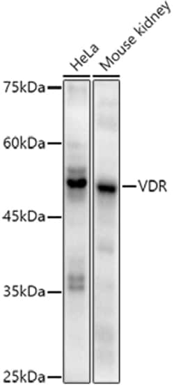Invitrogen VDR Recombinant Rabbit Monoclonal Antibody (2R1F6) 100 &mu;L;