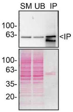 Invitrogen Beclin 1 Recombinant Rabbit Monoclonal Antibody (9D8K9) 100 &mu;L | Buy Online | Invitrogen&trade; | Fisher Scientific