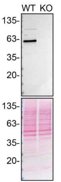 Invitrogen Beclin 1 Recombinant Rabbit Monoclonal Antibody (9D8K9) 100 &mu;L | Buy Online | Invitrogen&trade; | Fisher Scientific