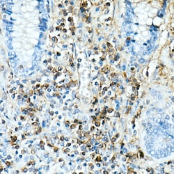 Invitrogen IL-17A Recombinant Rabbit Monoclonal Antibody (4V7Y6) 100 &mu;L;