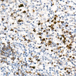 Invitrogen IL-17A Recombinant Rabbit Monoclonal Antibody (4V7Y6) 100 &mu;L;