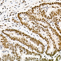 Invitrogen FTO Recombinant Rabbit Monoclonal Antibody (4A5T6) 100 &mu;L;