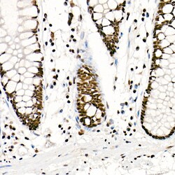 Invitrogen FTO Recombinant Rabbit Monoclonal Antibody (4A5T6) 100 &mu;L;