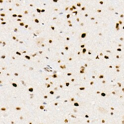 Invitrogen FTO Recombinant Rabbit Monoclonal Antibody (4A5T6) 100 &mu;L;