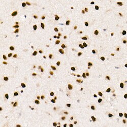 Invitrogen FTO Recombinant Rabbit Monoclonal Antibody (4A5T6) 100 &mu;L;