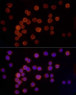 Invitrogen Cathepsin G Recombinant Rabbit Monoclonal Antibody (9K4D3) 100