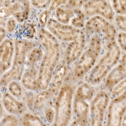 Invitrogen c-Abl Recombinant Rabbit Monoclonal Antibody (4Y8V9) 100 &mu;L;