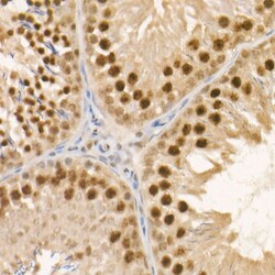 Invitrogen c-Abl Recombinant Rabbit Monoclonal Antibody (4Y8V9) 100 &mu;L;