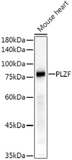 Invitrogen PLZF Recombinant Rabbit Monoclonal Antibody (8F9X2) 100 &mu;L;
