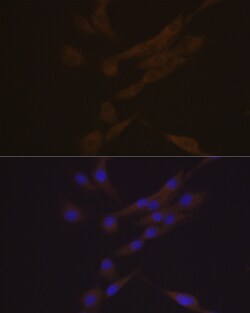 Invitrogen CHI3L1 Recombinant Rabbit Monoclonal Antibody (7T1R3) 100 &mu;L | Buy Online | Invitrogen&trade; | Fisher Scientific