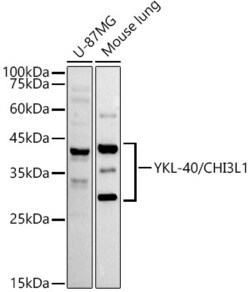 Invitrogen CHI3L1 Recombinant Rabbit Monoclonal Antibody (7T1R3) 100 &mu;L | Buy Online | Invitrogen&trade; | Fisher Scientific