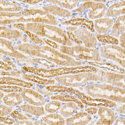 Invitrogen SIRT3 Recombinant Rabbit Monoclonal Antibody (7O4G7) 100 &mu;L;