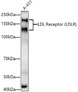 Invitrogen LDLR Recombinant Rabbit Monoclonal Antibody (10K4L8) 100 &mu;L;