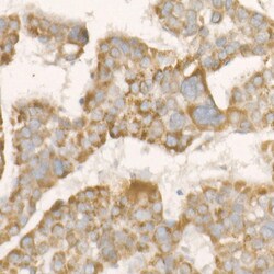 Invitrogen PGAM5 Recombinant Rabbit Monoclonal Antibody (7J3A5) 100 &mu;L;