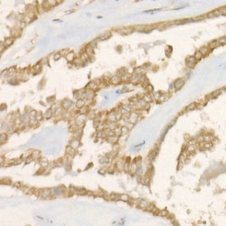 Invitrogen PGAM5 Recombinant Rabbit Monoclonal Antibody (7J3A5) 100 &mu;L;