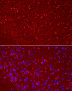 Invitrogen DKK3 Recombinant Rabbit Monoclonal Antibody (7O2I10) 100 &mu;L;