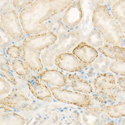 Invitrogen AMID Recombinant Rabbit Monoclonal Antibody (7X9B2) 100 &mu;L;