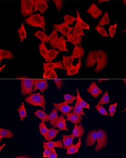 Invitrogen S100A11 Recombinant Rabbit Monoclonal Antibody (8U1Y8) 100 &mu;L | Buy Online | Invitrogen&trade; | Fisher Scientific