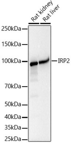 Invitrogen IREB2 Recombinant Rabbit Monoclonal Antibody (4I4R1) 100 &mu;L | Buy Online | Invitrogen&trade; | Fisher Scientific