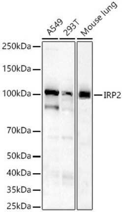 Invitrogen IREB2 Recombinant Rabbit Monoclonal Antibody (4I4R1) 100 &mu;L | Buy Online | Invitrogen&trade; | Fisher Scientific