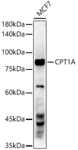 Invitrogen CPT1A Recombinant Rabbit Monoclonal Antibody (3M6E9) 100 &mu;L;