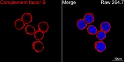 Invitrogen Complement Factor B Recombinant Rabbit Monoclonal Antibody (6D3N9)