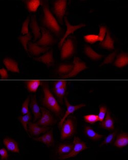 Invitrogen AKR1B1 Recombinant Rabbit Monoclonal Antibody (8W5L1) 100 &mu;L;