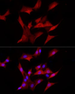 Invitrogen AKR1B1 Recombinant Rabbit Monoclonal Antibody (8W5L1) 100 &mu;L;