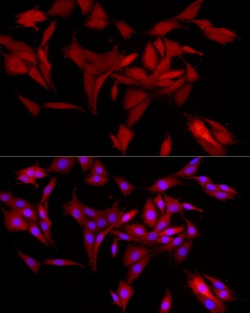 Invitrogen AKR1B1 Recombinant Rabbit Monoclonal Antibody (8W5L1) 100 &mu;L;