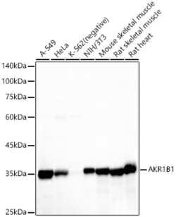 Invitrogen AKR1B1 Recombinant Rabbit Monoclonal Antibody (8W5L1) 100 &mu;L;