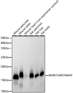 Invitrogen ARMET Recombinant Rabbit Monoclonal Antibody (8I8D5) 100 &mu;L;