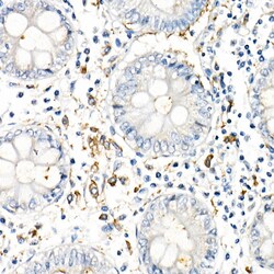 Invitrogen TNF alpha Recombinant Rabbit Monoclonal Antibody (2Y4O4) 100
