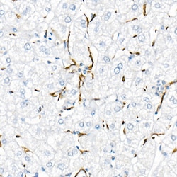 Invitrogen TNF alpha Recombinant Rabbit Monoclonal Antibody (2Y4O4) 100