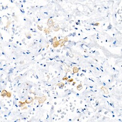 Invitrogen TNF alpha Recombinant Rabbit Monoclonal Antibody (2Y4O4) 100