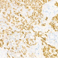 Invitrogen IL23R Recombinant Rabbit Monoclonal Antibody (5M2U3) 100 &mu;L;