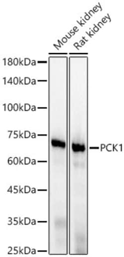 Invitrogen PCK1 Recombinant Rabbit Monoclonal Antibody (4N1E6) 100 &mu;L;