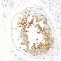 Invitrogen SPAM1 Recombinant Rabbit Monoclonal Antibody (4N0R3) 100 &mu;L;