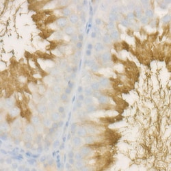 Invitrogen SPAM1 Recombinant Rabbit Monoclonal Antibody (4N0R3) 100 &mu;L;