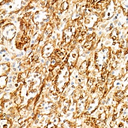 Invitrogen STING Recombinant Rabbit Monoclonal Antibody (9V9A3) 100 &mu;L;